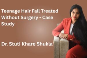 Teenage Hair Fall Treated Without Surgery - Case Study
