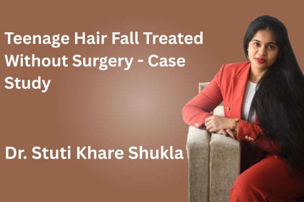 Teenage Hair Fall Treated Without Surgery - Case Study