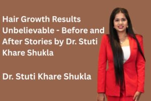 Hair Growth Results Unbelievable - Before and After Stories by Dr. Stuti Khare Shukla