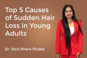 Top 5 Causes of Sudden Hair Loss in Young Adults