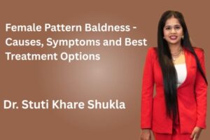 Female Pattern Baldness - Causes, Symptoms and Best Treatment Options