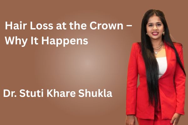 Hair Loss at the Crown – Why It Happens